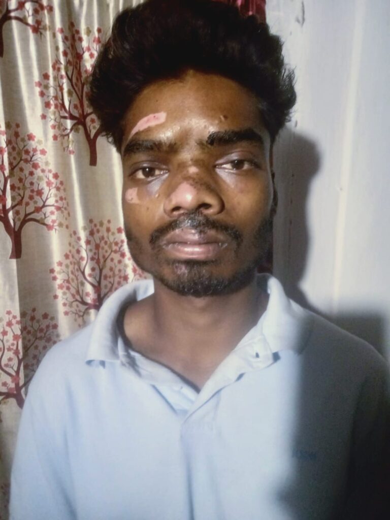 सड़क दुर्घटना पीड़ित को मिला तत्काल निःशुल्क उपचार, धमतरी में पीएम-राहत योजना का पहला सफल कैशलेस इलाज