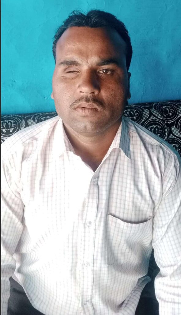 कटनी के बहोरीबंद में “एक आंख खोने के बाद भी सिर्फ 30% विकलांगता? प्रशासनिक लापरवाही से जूझता जगत यादव”