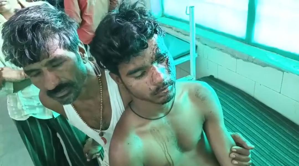 कटनी के रीठी थाना अंतर्गत घर के सामने कचरा डालने को लेकर खूनी बवाल,एक ही परिवार के दो पक्षों में चली लाठियां, चार घायल — दो की हालत गंभीर