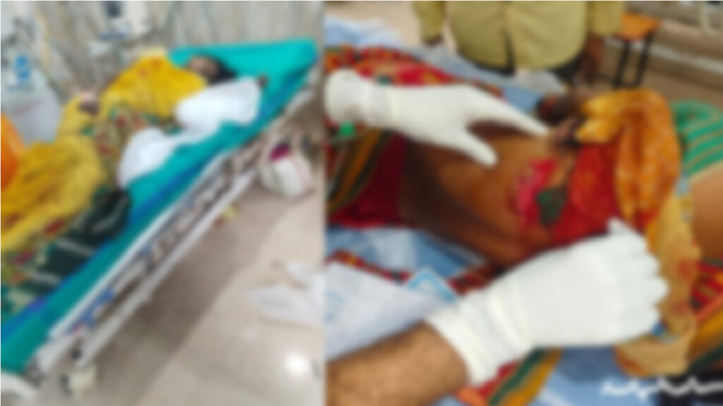 Chhattisgarh News : जंगली सुअर का आतंक , तेंदूपत्ता तोड़ने गई 5 महिलाएं हमले में गंभीर रूप से घायल Chhattisgarh News