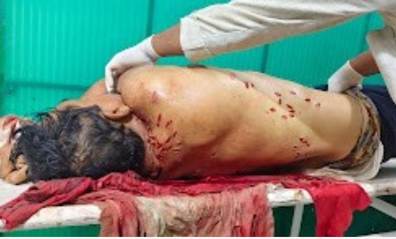 *चार संदिग्ध हिरासत में: नगरी के कारोबारी की निर्मम हत्या, 40 से अधिक वार कर उतारा मौत के घाट; पुरानी रंजिश की आशंका, जल्द होगा खुलासा*