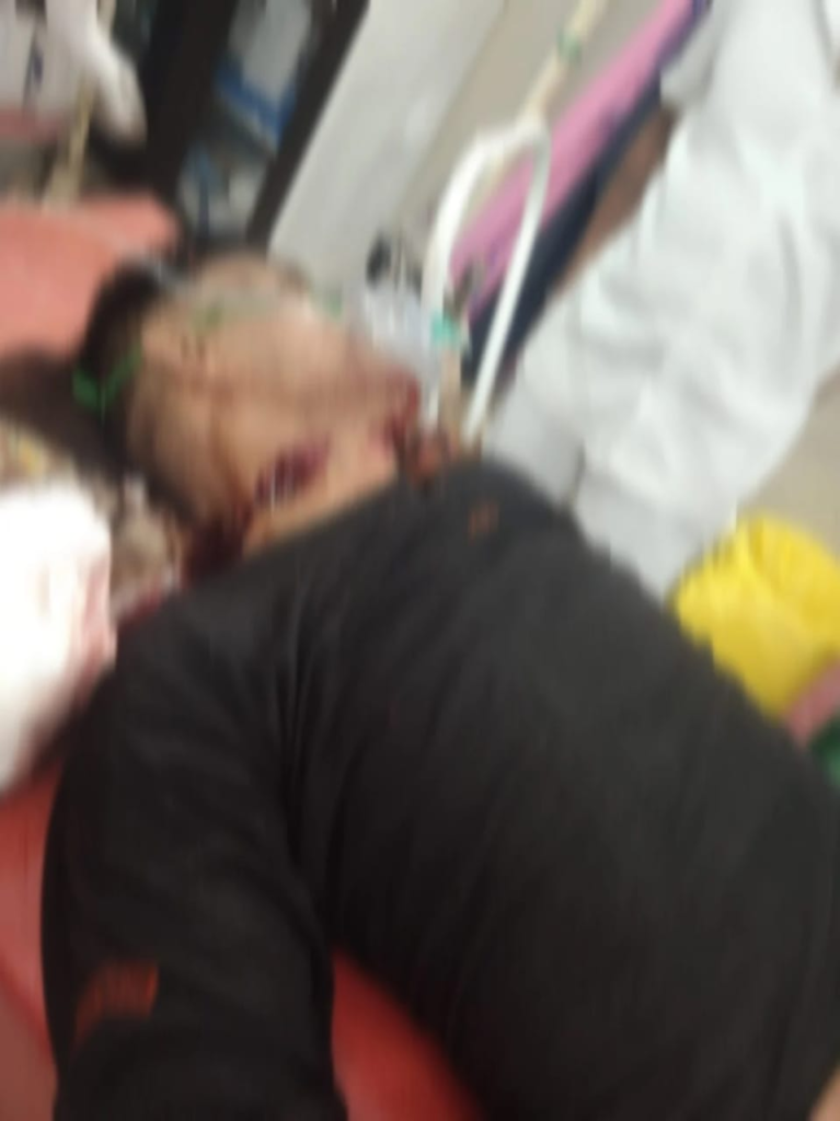अवैध संबंध का खौफनाक अंजाम, पत्नी के कथित प्रेमी की कुल्हाड़ी से काटकर हत्या, आरोपी फरार